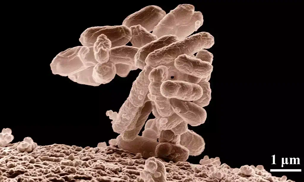 Escherichia coli si riproduce sulla parete vescicale