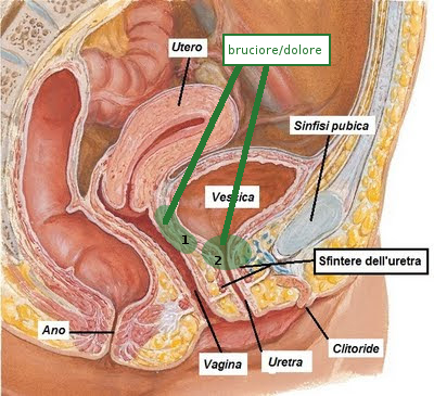 sfintere uretrale femminile.jpg