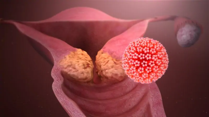 papilloma virus quanto tempo si sviluppa