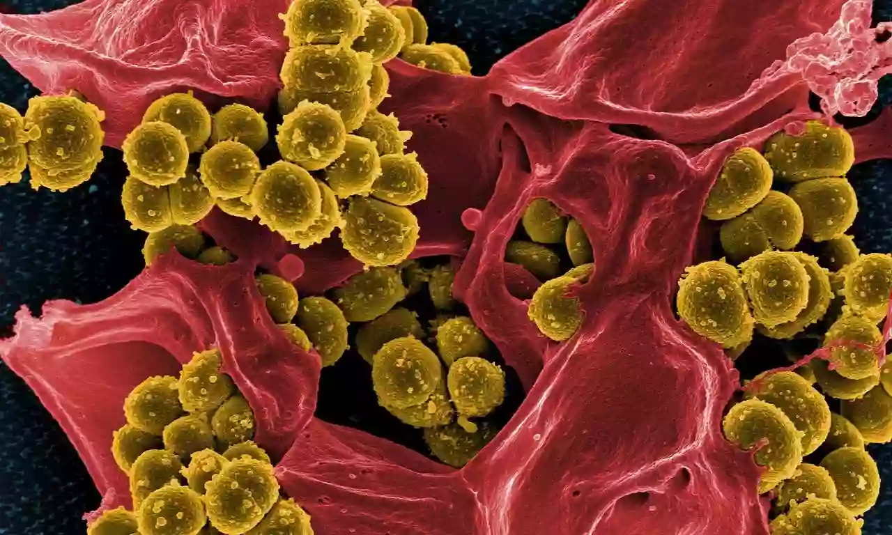 Batteri causano infezione e infiammazione